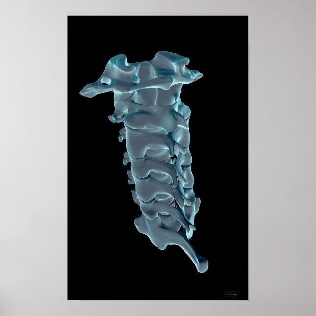 Cervical Vertebrae Poster (Framsidan)