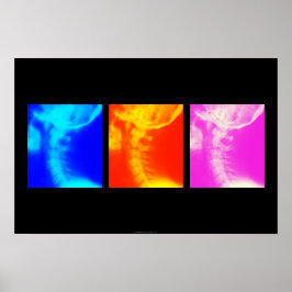 Cervikal röntgenchiropraktik poster 1
