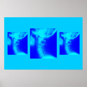 Chiropracticaffisch: SidoCervical deppighet Poster