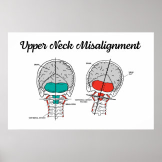 Chiropraktic Upper Cervical Poster