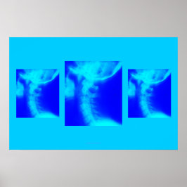 Chiropraktik Poster: Lateral Cervical Blues Poster