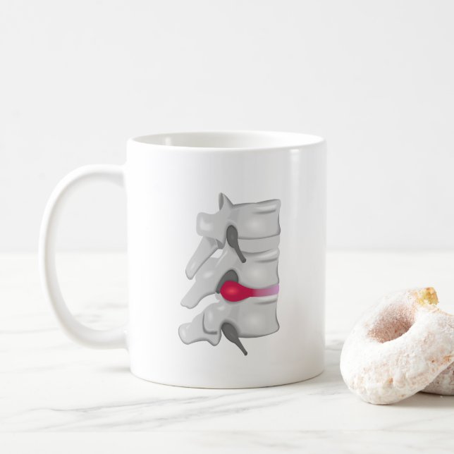 Chiropraktor Bakkirurg Kaffemugg (Med munk)