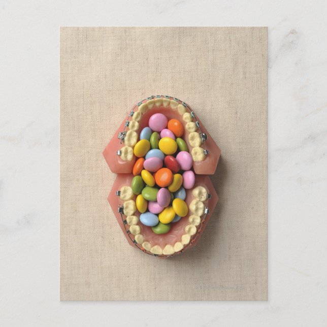 Chokladen tjänade i tandmodellen vykort (Framsida)