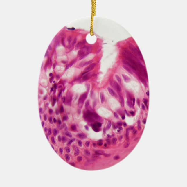 Ciliated epitel under mikroskopet julgransprydnad keramik (Framsidan)