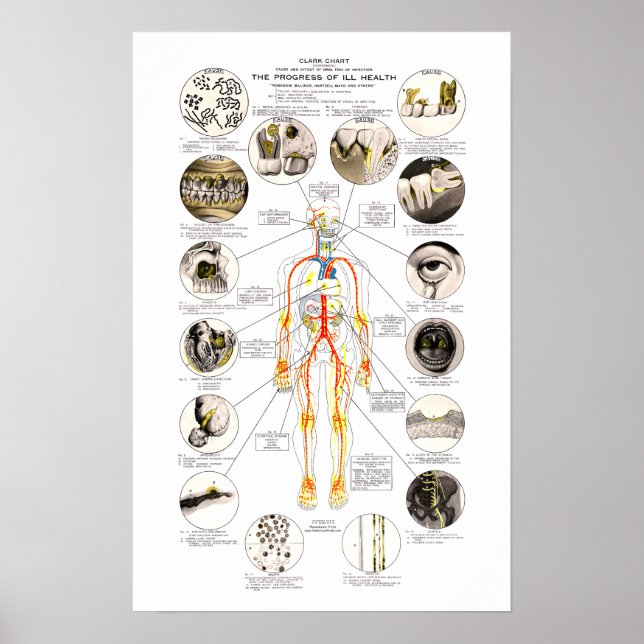 Clark Dental Health Chart for Dentist Poster (Framsidan)