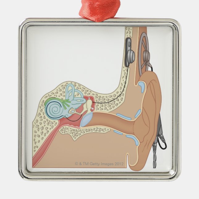 Cochlear implantat julgransprydnad metall (Framsidan)
