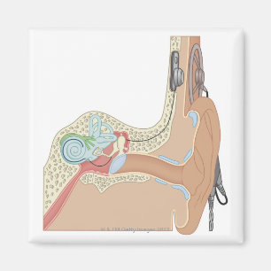 Cochlear implantat magnet