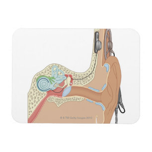 Cochlear implantat magnet