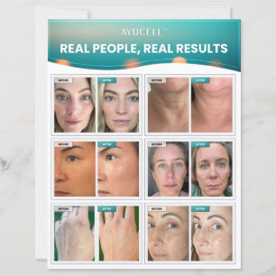 Consumer Sell Lakan - Real People, Real Results