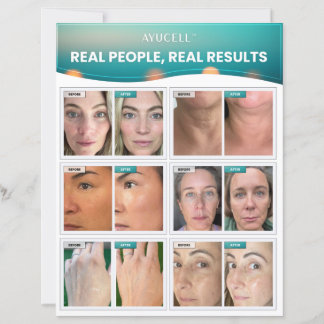 Consumer Sell Lakan - Real People, Real Results