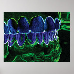 Coola Teeth Model Dentist Orthodontist Poster