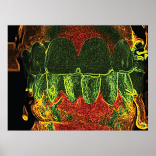Crazy Teeth Bita Dentist Orthodontist Poster
