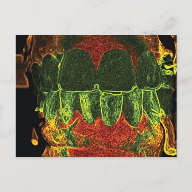 Crazy Teeth-modellens designtandkort Vykort (Framsida)