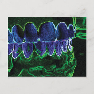 Crazy Teeth-modellens tandläkarkort Vykort