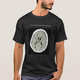 CT Scan_ CTFOD_Detta är vad depression ser ut som T Shirt