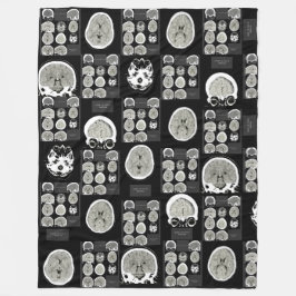 CT Scan_this är depression_BLK_CTFOD Fleecefilt