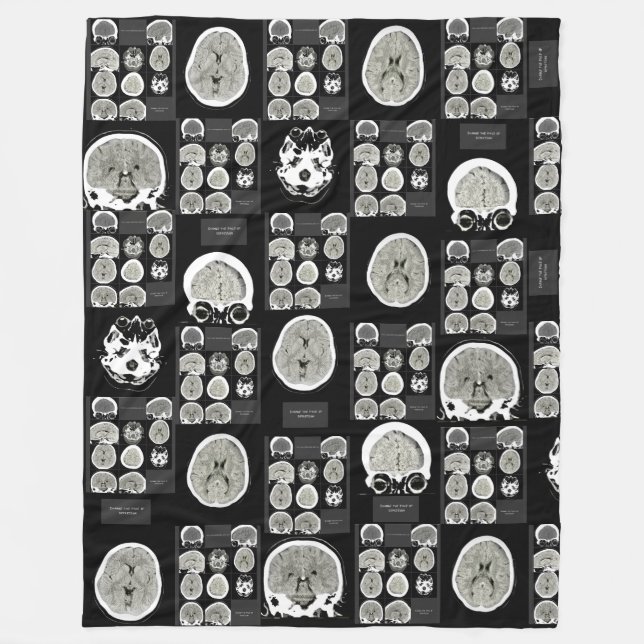 CT Scan_this är depression_BLK_CTFOD Fleecefilt (Framsidan)