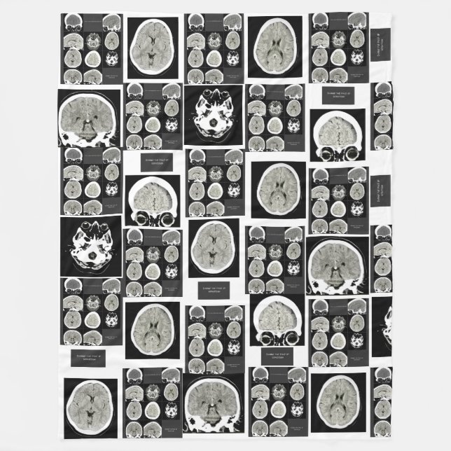 CT Scan_this är depression_CTFOD Fleecefilt (Framsidan)