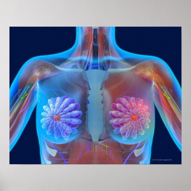 Datorkonst som representerar bröstcancer. poster (Framsidan)