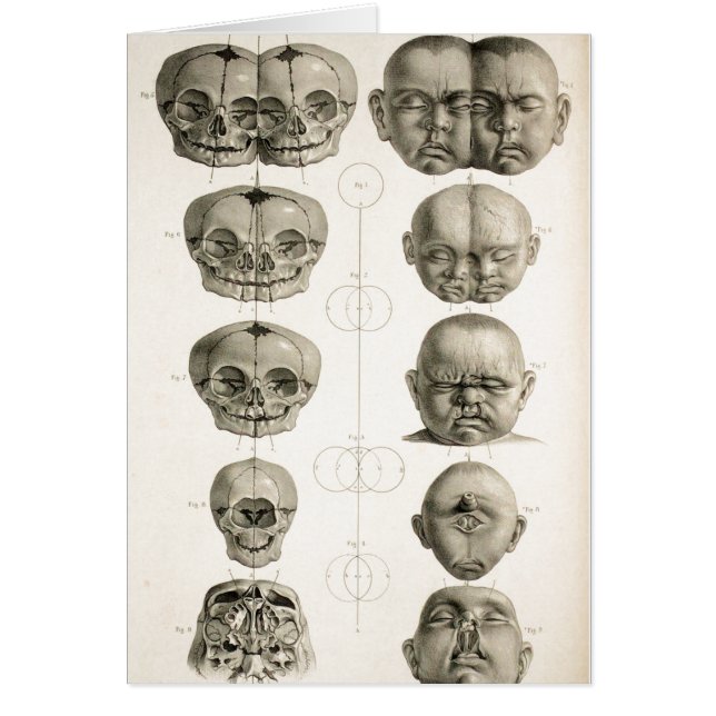 Den begynna skallemissbildningkonstigen/Conjoin Hälsningskort (Framsidan)