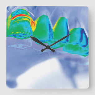 Den original- väggen för tanddesigntandläkaren tar fyrkantig klocka