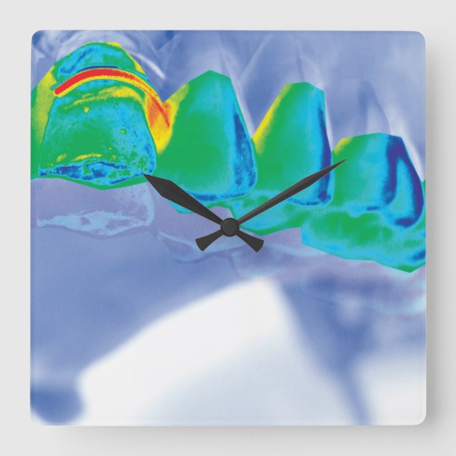 Den original- väggen för tanddesigntandläkaren tar fyrkantig klocka (Framsida)