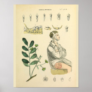 Dental Teeth Jaw Vintage Anatomy Art Skriv ut Poster