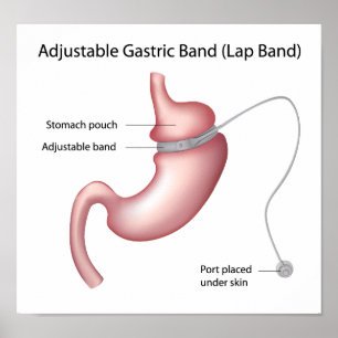 Det Gastric musikbandet väger Poster