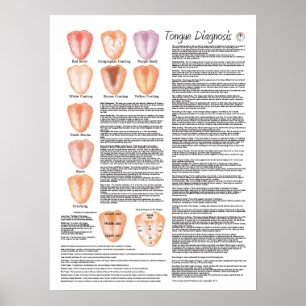 Diagnostikakupunktur för kinesisk Tunga Poster