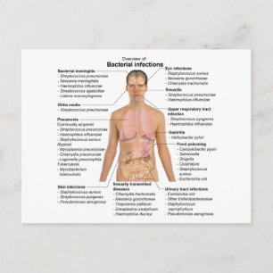 Diagram över bakterieinfektioner hos människor vykort