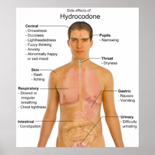 Diagram över biverkningar av opioidhydrokodon poster