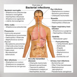 Diagram över de huvudsakliga bakterieinfektionerna poster