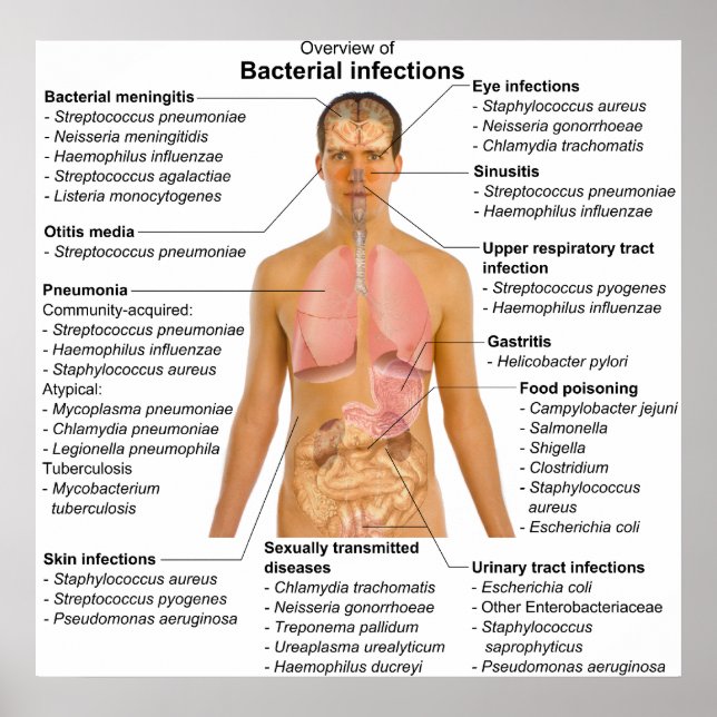 Diagram över de huvudsakliga bakterieinfektionerna poster (Framsidan)