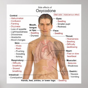 Diagram över de viktigaste biverkningarna av oxiko poster