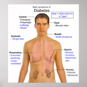 Diagram över de viktigaste symtomen på diabetes ho poster