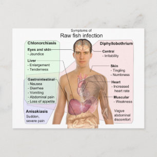 Diagram över symtom på obehandlad fiskinfektion vykort