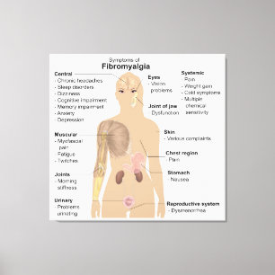 Diagramsymboler Symptomen Fibromyalgia-Kanvastryck Canvastryck