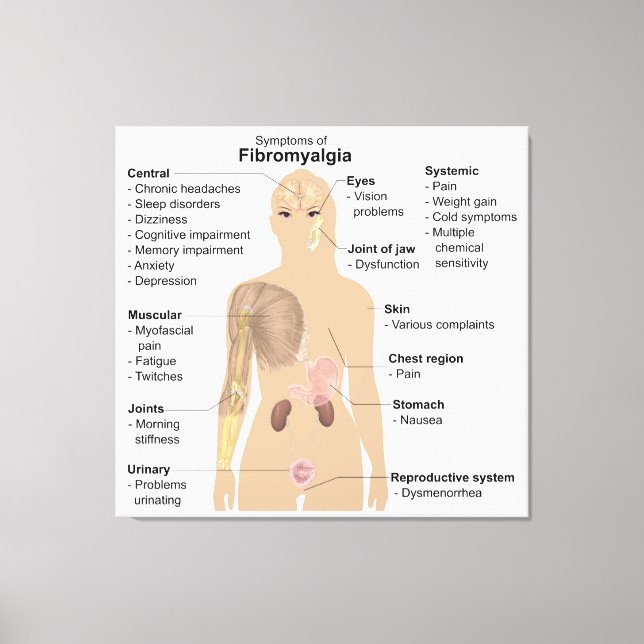 Diagramsymboler Symptomen Fibromyalgia-Kanvastryck Canvastryck (Framsida)