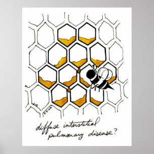 Diffus Interstitiell lungsjukdom Poster