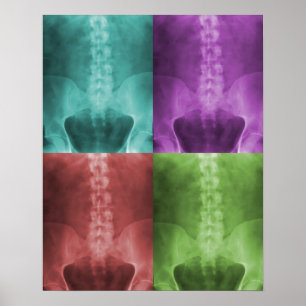 Digital röntgar konsttrycket poster