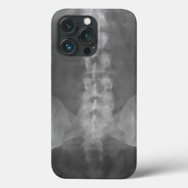 Digital X-Ray Art (Baksida)