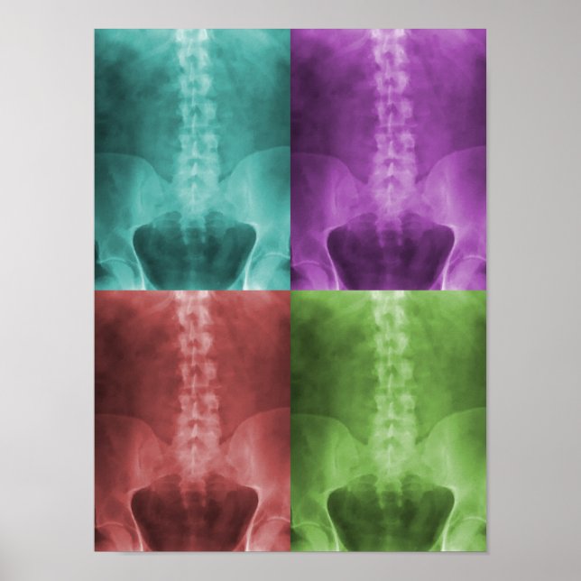 Digital X-Ray Art Canvas Poster (Framsidan)