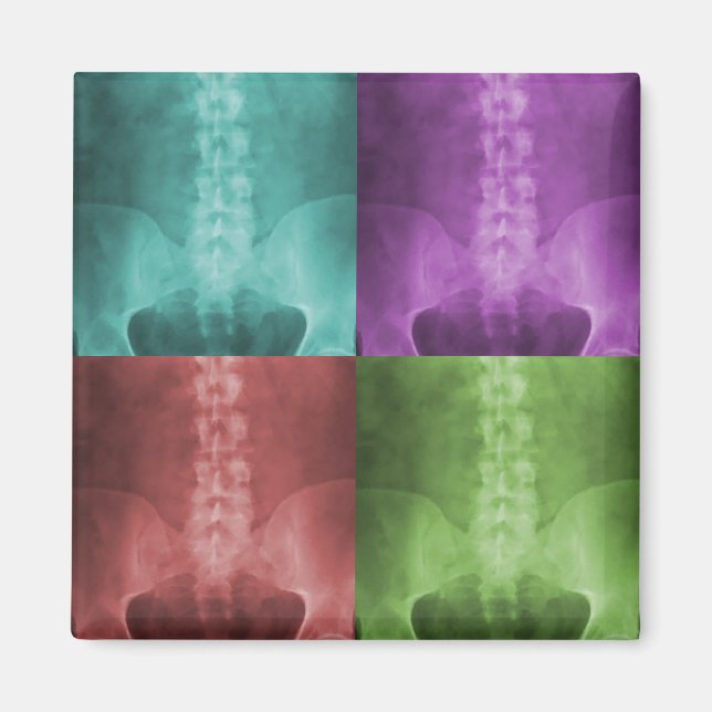 Digital X-Ray Art Magnet (Framsidan)
