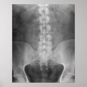 Digital X-Ray Art-utskrift Poster