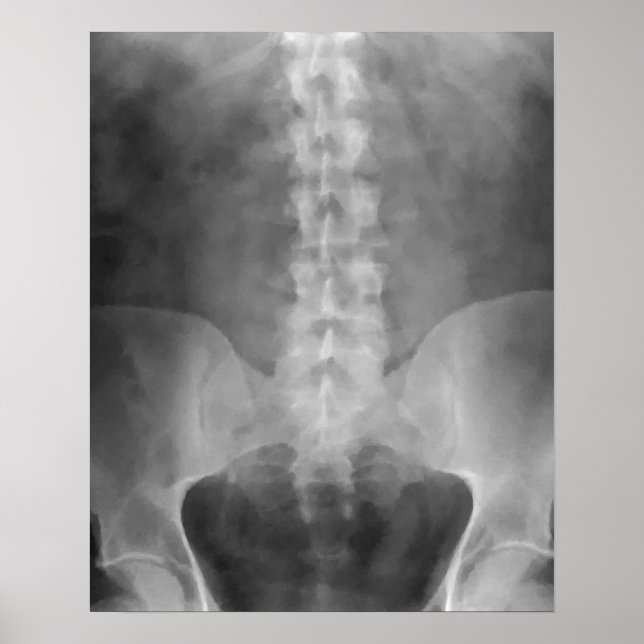 Digital X-Ray Art-utskrift Poster (Framsidan)