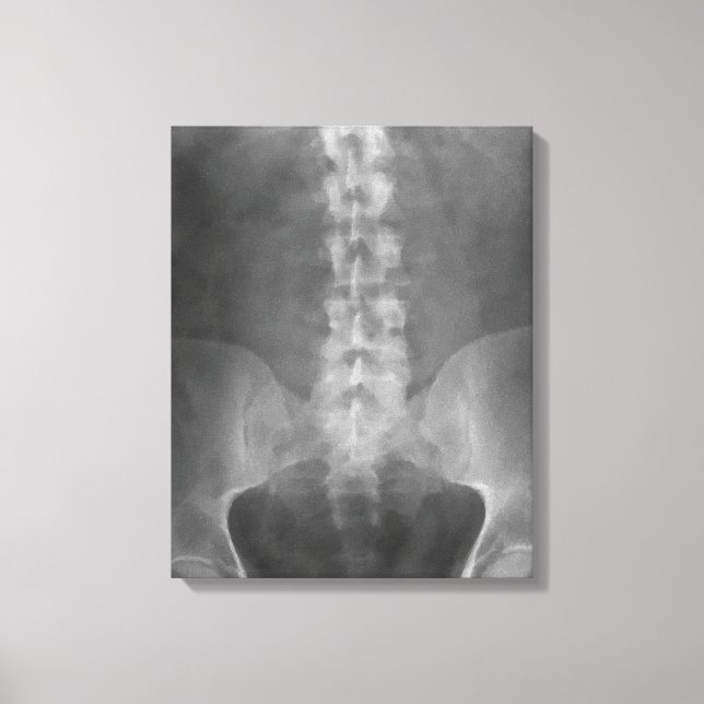 Digital X-Ray Art Wrapped Canvas (Framsida)