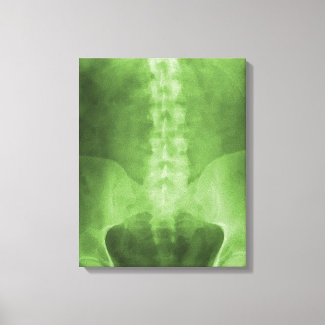 Digital X-Ray Art Wrapped Canvas (Framsida)