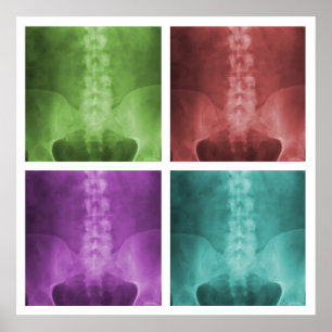 Digital X-Ray-filmruta Poster fyrkantsruta