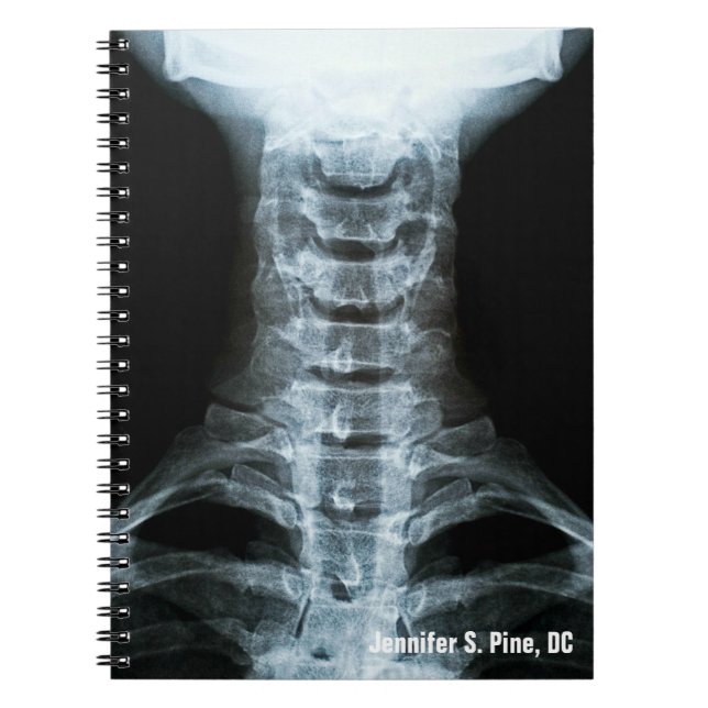 Digital X-Ray-Personlig bärbar dator Anteckningsbok Med Spiral (Framsidan)