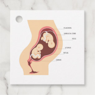 Dizygotisk tvillinggravid gåvor etiketter